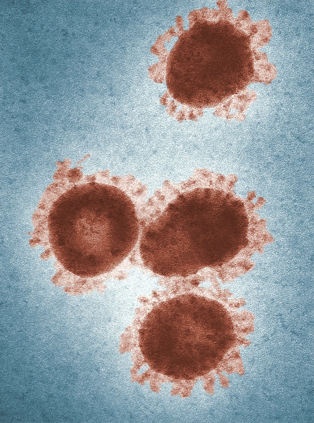 immune system photo of virus